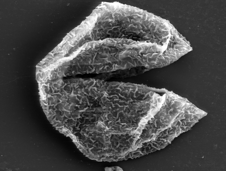 Mendicodinium mataschenensis.png